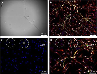 Purification of Fibroblasts From the Spiral Ganglion